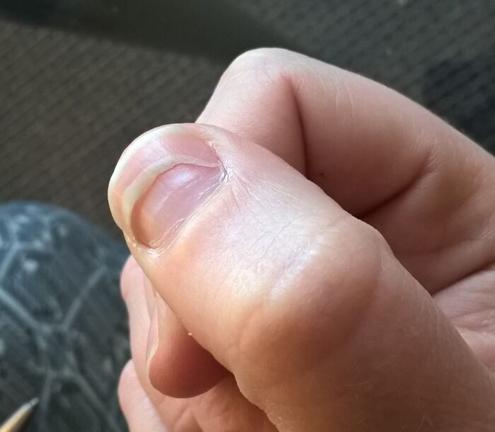 74 People Share Rare And Surprising Things About Their Bodies (New Pics)