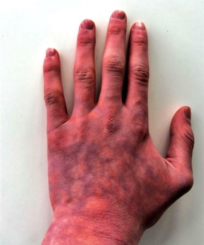 74 People Share Rare And Surprising Things About Their Bodies (New Pics)