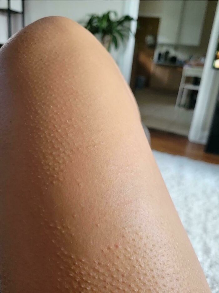 74 People Share Rare And Surprising Things About Their Bodies (New Pics)