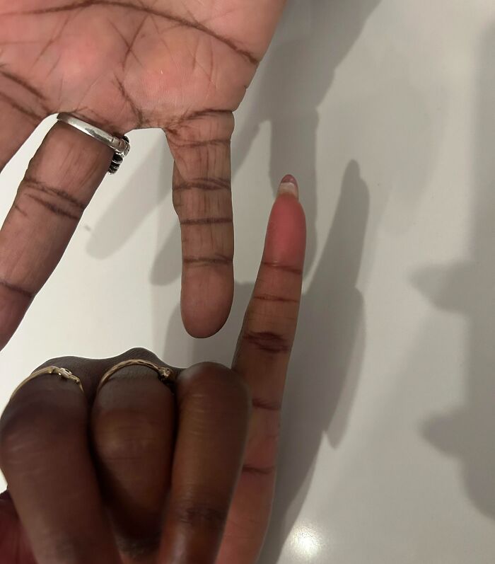 74 People Share Rare And Surprising Things About Their Bodies (New Pics)