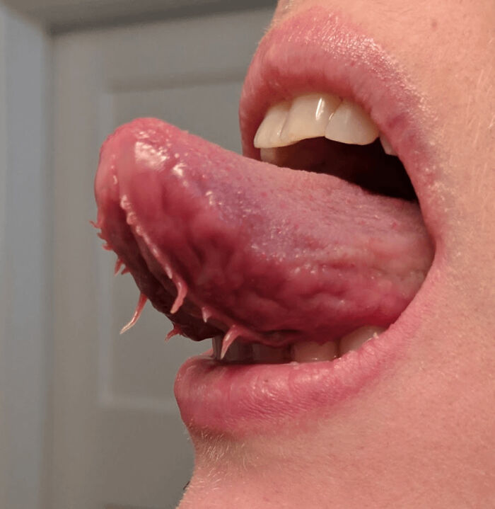 74 People Share Rare And Surprising Things About Their Bodies (New Pics)
