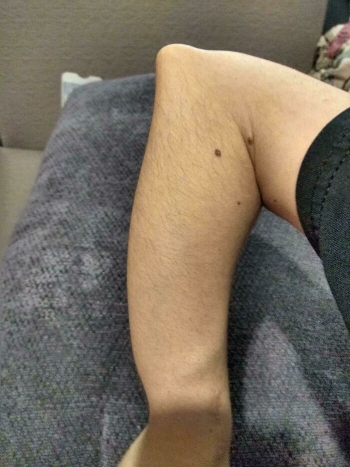 74 People Share Rare And Surprising Things About Their Bodies (New Pics)