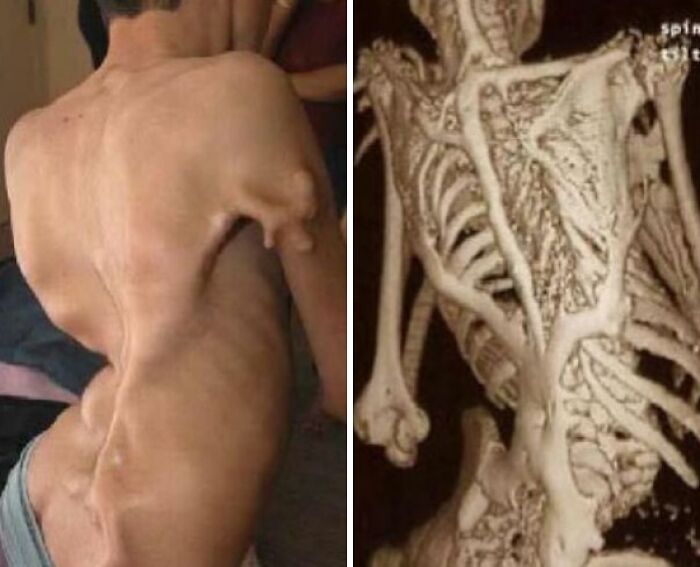 74 People Share Rare And Surprising Things About Their Bodies (New Pics)