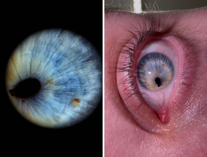 74 People Share Rare And Surprising Things About Their Bodies (New Pics)