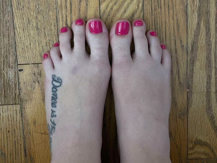 74 People Share Rare And Surprising Things About Their Bodies (New Pics)
