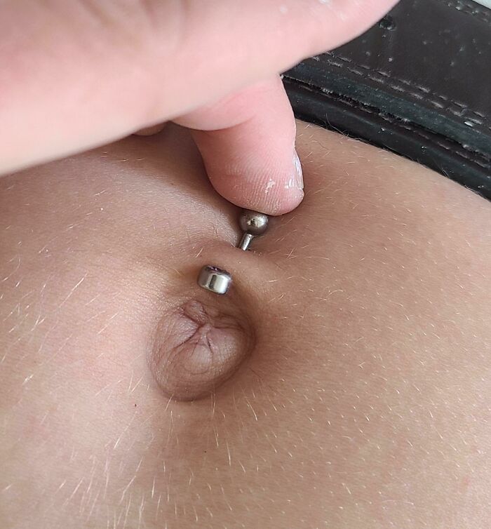 74 People Share Rare And Surprising Things About Their Bodies (New Pics)