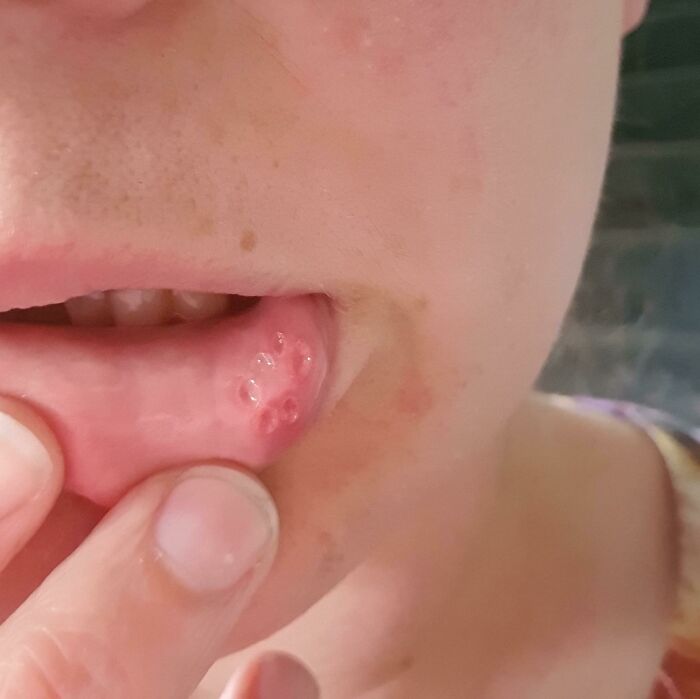 74 People Share Rare And Surprising Things About Their Bodies (New Pics)