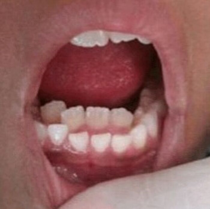 74 People Share Rare And Surprising Things About Their Bodies (New Pics)
