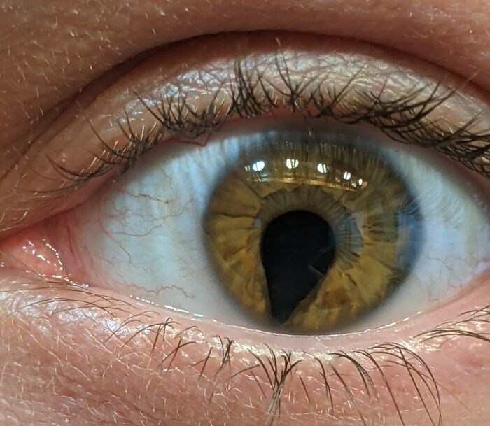 74 People Share Rare And Surprising Things About Their Bodies (New Pics)