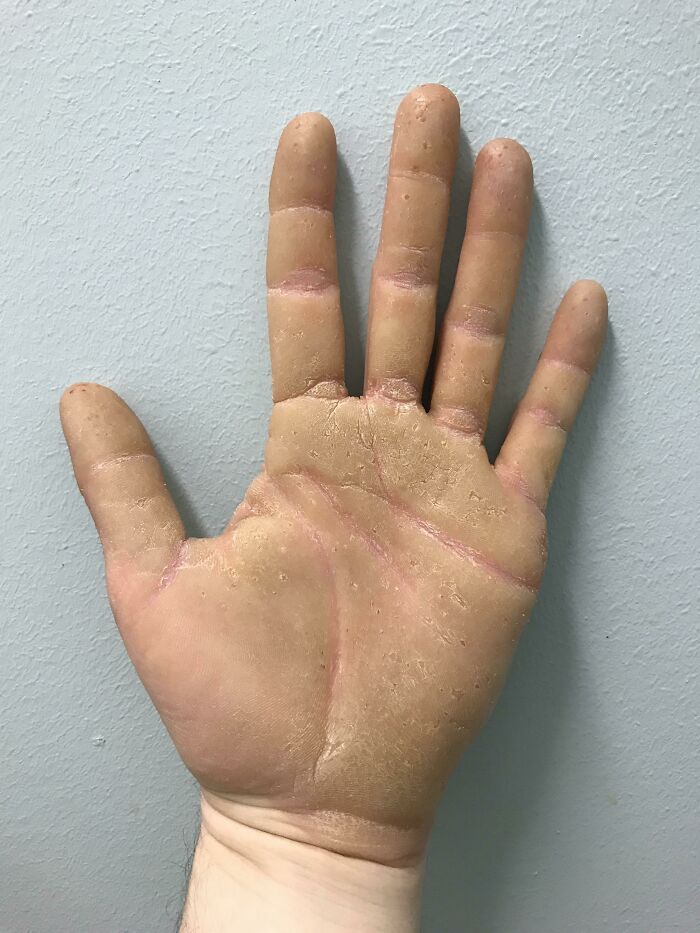 74 People Share Rare And Surprising Things About Their Bodies (New Pics)