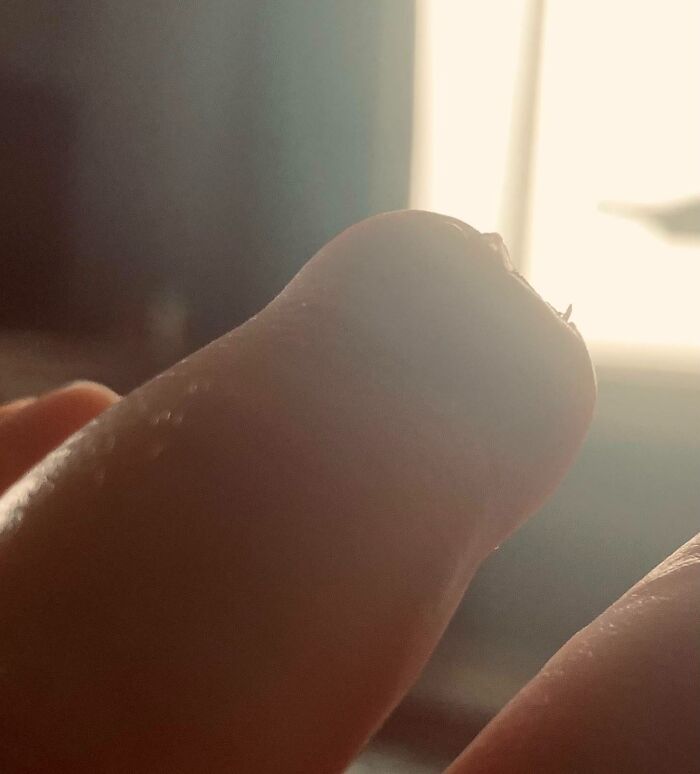 74 People Share Rare And Surprising Things About Their Bodies (New Pics)