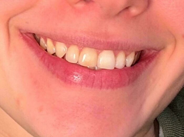 74 People Share Rare And Surprising Things About Their Bodies (New Pics)