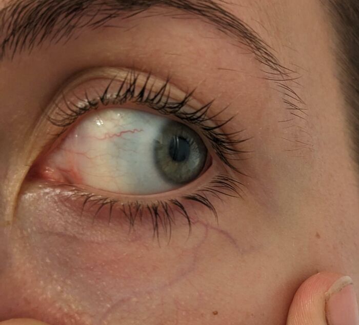 74 People Share Rare And Surprising Things About Their Bodies (New Pics)
