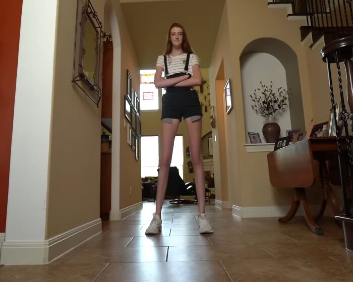 74 People Share Rare And Surprising Things About Their Bodies (New Pics)