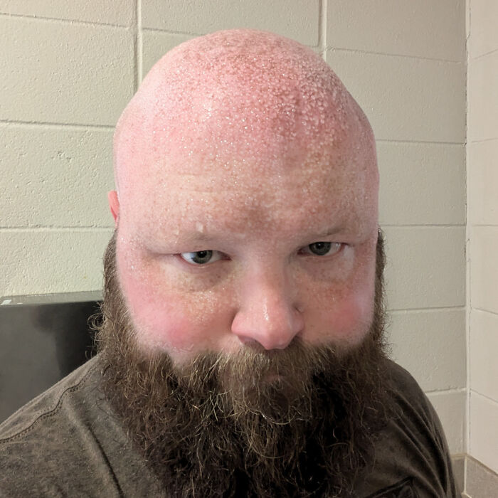74 People Share Rare And Surprising Things About Their Bodies (New Pics)