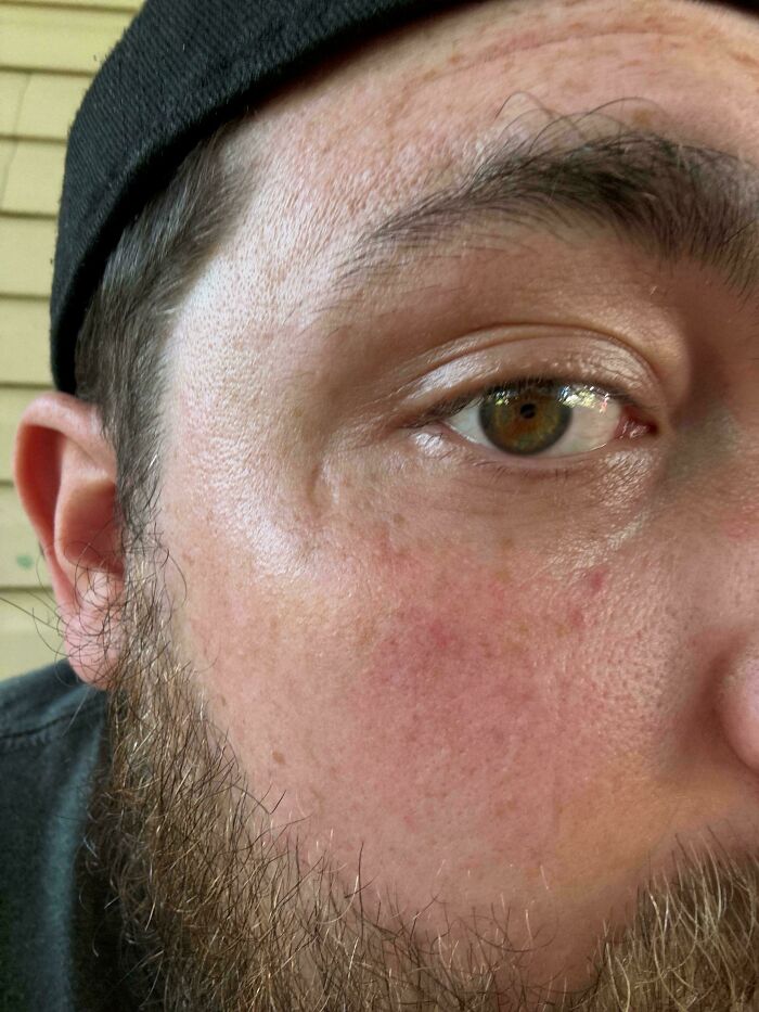 74 People Share Rare And Surprising Things About Their Bodies (New Pics)