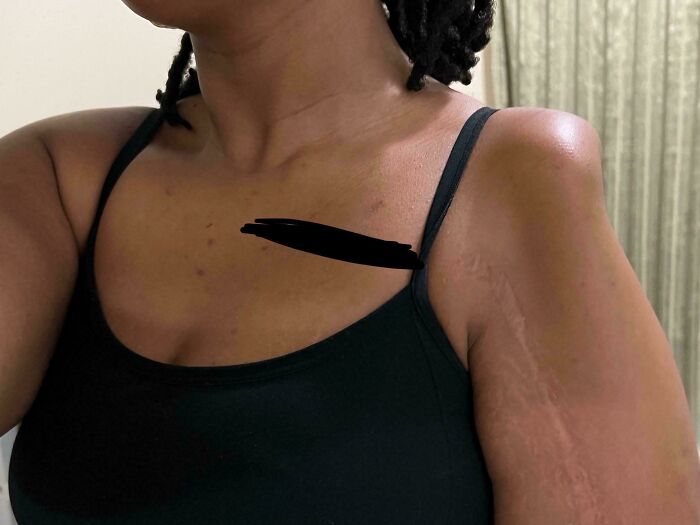 74 People Share Rare And Surprising Things About Their Bodies (New Pics)