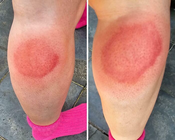 74 People Share Rare And Surprising Things About Their Bodies (New Pics)