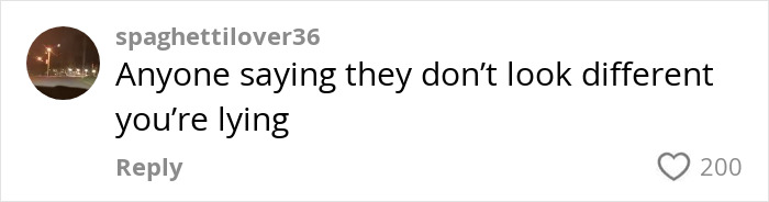 Woman&#8217;s &#8216;Kybella&#8217; Face Transformation Stuns People After Her Extreme Recovery Phase Goes Viral