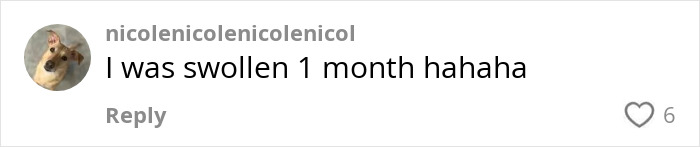 Woman&#8217;s &#8216;Kybella&#8217; Face Transformation Stuns People After Her Extreme Recovery Phase Goes Viral