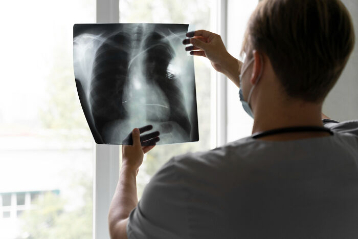 29 Scary Times Doctors Brushed Off Someone’s Symptoms As “Just Anxiety” But It Was Anything But