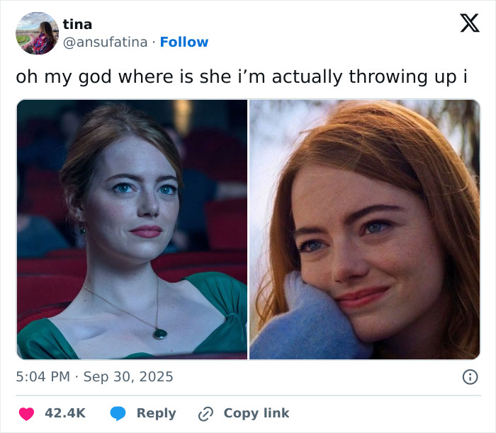 “Give Her Her Eyes Back”: Fans Claim Emma Stone Underwent Plastic Surgery To Change Eye Region