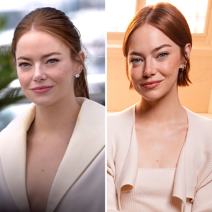 “Give Her Her Eyes Back”: Fans Claim Emma Stone Underwent Plastic Surgery To Change Eye Region