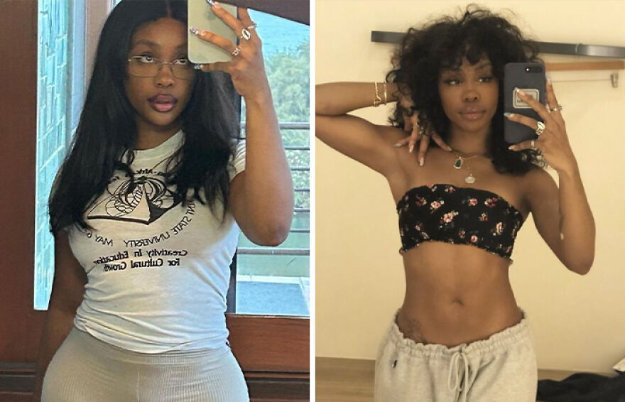 SZA’s “Before And After” Confessions And The Aftermath Of Cosmetic Transformation