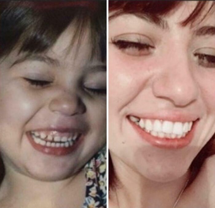 “Same Love, Different Decade”: 60 Comparison Pics Of How People Looked Back Then And Now (New Pics)