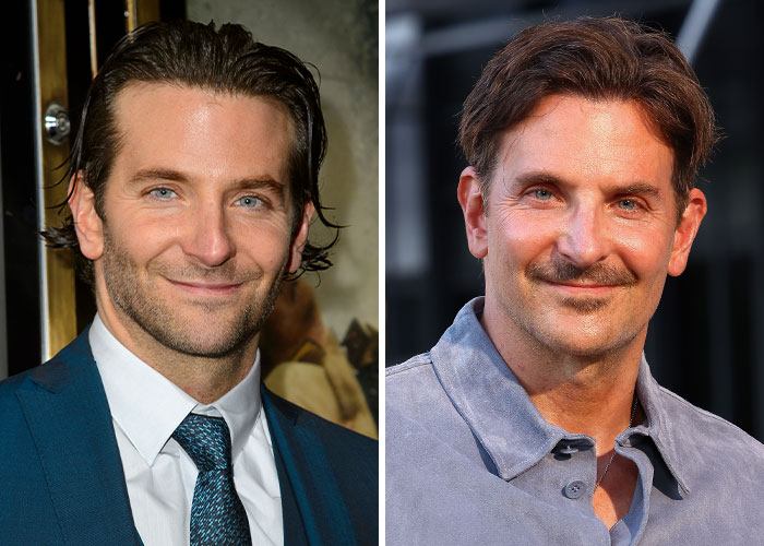 Plastic Surgeons Comment On Bradley Cooper&#8217;s Seemingly New Look