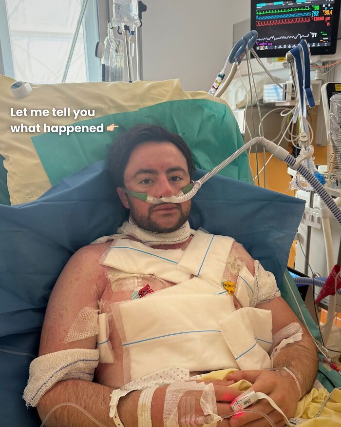 Man Who Swam For 110 Miles Without Sleeping Reveals &#8220;Intense&#8221; Hallucinatory Experience