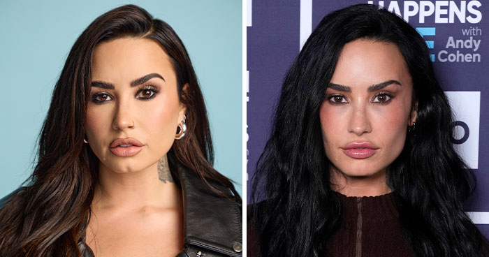 &#8220;Bring Buccal Fat Back&#8221;: Demi Lovato’s Dramatic New Look Sparks Plastic Surgery Speculation