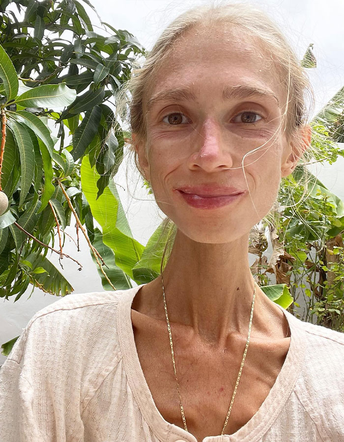 Vegan Woman, 27, Found Lifeless In Hotel Room After Adopting New Raw Diet