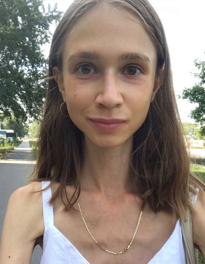Vegan Woman, 27, Found Lifeless In Hotel Room After Adopting New Raw Diet