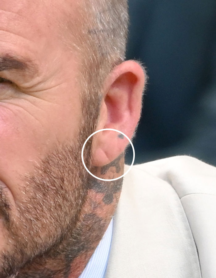 Health Expert Issues Chilling Warning After Spotting Alarming Sign On David Beckham