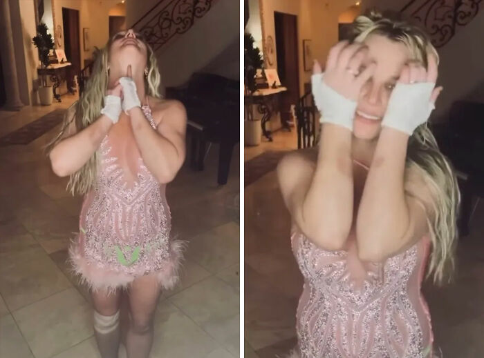 Britney Spears Makes Concerning Claim About “Horrible” Accident While Being Covered In Bruises