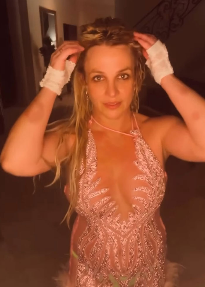 Britney Spears Makes Concerning Claim About “Horrible” Accident While Being Covered In Bruises