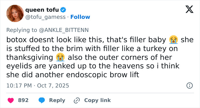 “Morphing Into MAGA”: Taylor Swift Fans Call Out Cosmetic Procedures After New Interview Goes Viral “Morphing Into MAGA”: Taylor Swift Fans Call Out Cosmetic Procedures After New Interview Goes Viral