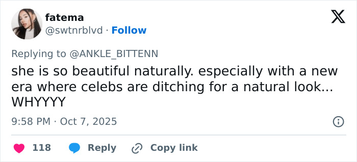 “Morphing Into MAGA”: Taylor Swift Fans Call Out Cosmetic Procedures After New Interview Goes Viral “Morphing Into MAGA”: Taylor Swift Fans Call Out Cosmetic Procedures After New Interview Goes Viral