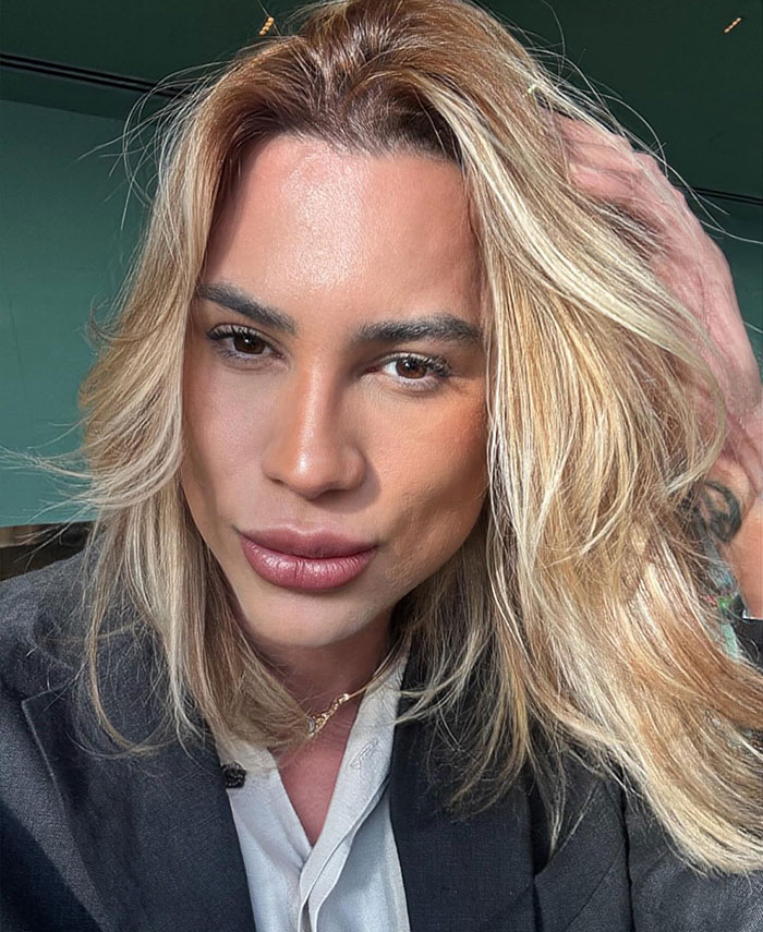 Influencer Passes Away After Exposing Complications From Popular &#8216;Fox Eyes’ Surgery