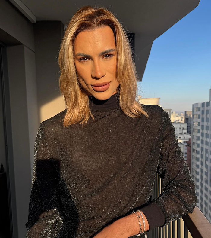 Influencer Passes Away After Exposing Complications From Popular &#8216;Fox Eyes’ Surgery