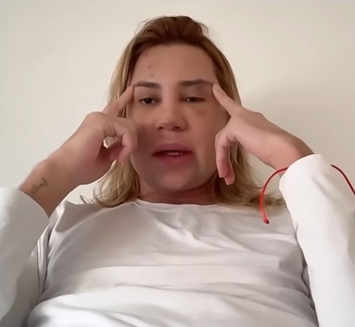 Influencer Passes Away After Exposing Complications From Popular &#8216;Fox Eyes’ Surgery