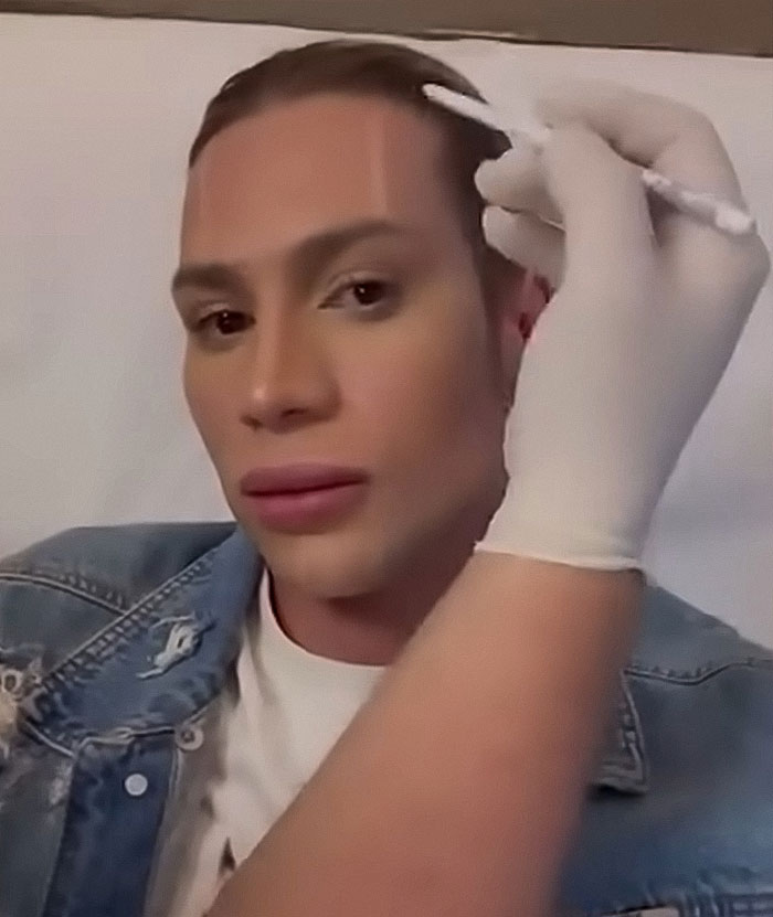 Influencer Passes Away After Exposing Complications From Popular &#8216;Fox Eyes’ Surgery