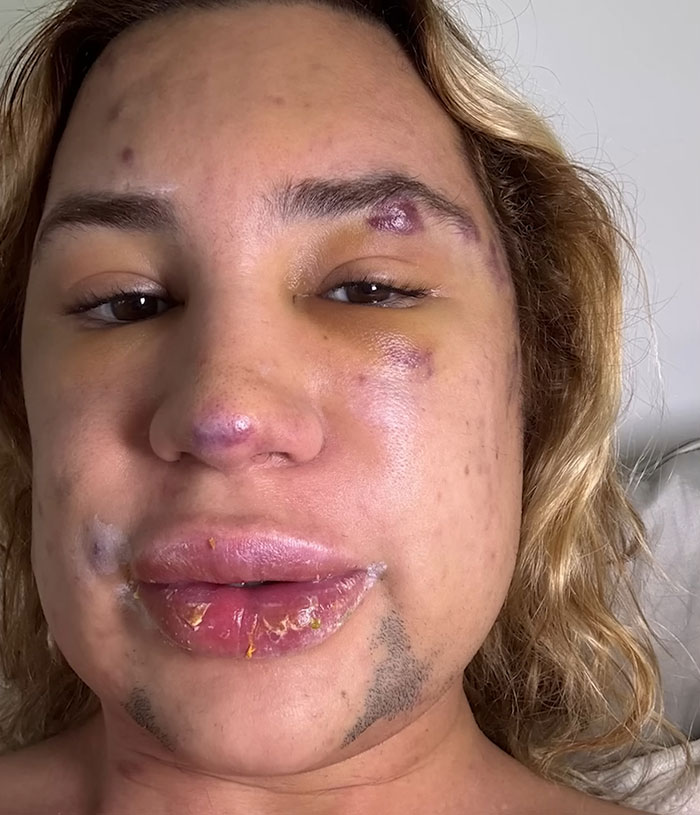 Influencer Passes Away After Exposing Complications From Popular &#8216;Fox Eyes’ Surgery