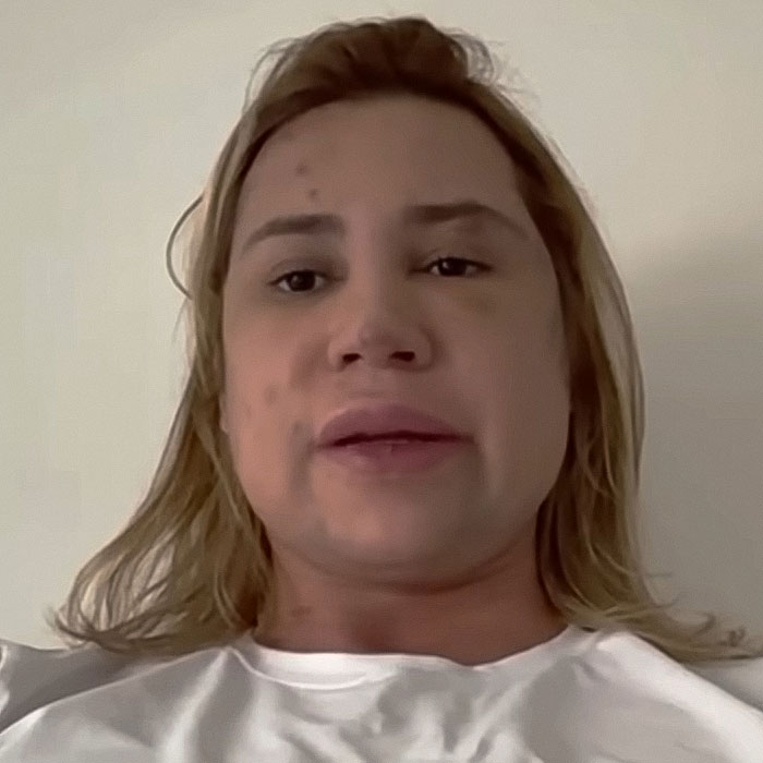 Influencer Passes Away After Exposing Complications From Popular &#8216;Fox Eyes’ Surgery