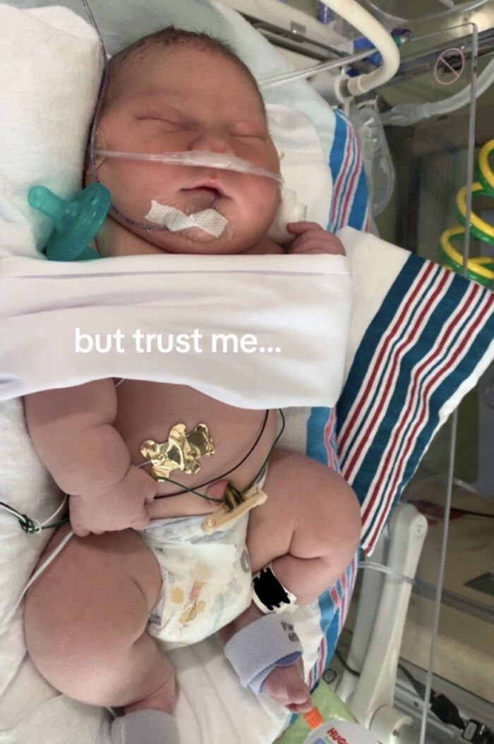 Mom Goes Viral After Delivering Baby Who Broke Hospital Record: &#8220;Absolutely Horrifying&#8221;