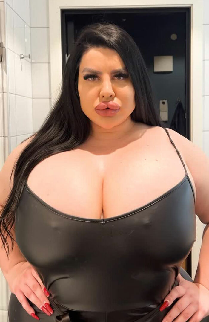 Plastic Surgery Enthusiast Who Paid $148k For 5 BBLs Shocks The Internet With Her ‘Before’ Photos Plastic Surgery Enthusiast Who Paid $148k For 5 BBLs Shocks The Internet With Her ‘Before’ Photos