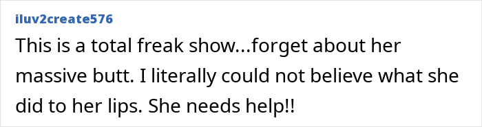 Plastic Surgery Enthusiast Who Paid $148k For 5 BBLs Shocks The Internet With Her ‘Before’ Photos Plastic Surgery Enthusiast Who Paid $148k For 5 BBLs Shocks The Internet With Her ‘Before’ Photos