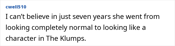 Plastic Surgery Enthusiast Who Paid $148k For 5 BBLs Shocks The Internet With Her ‘Before’ Photos Plastic Surgery Enthusiast Who Paid $148k For 5 BBLs Shocks The Internet With Her ‘Before’ Photos