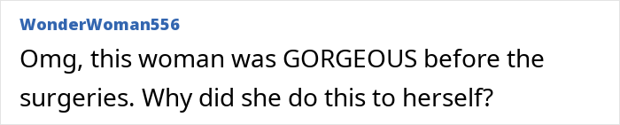 Plastic Surgery Enthusiast Who Paid $148k For 5 BBLs Shocks The Internet With Her ‘Before’ Photos Plastic Surgery Enthusiast Who Paid $148k For 5 BBLs Shocks The Internet With Her ‘Before’ Photos